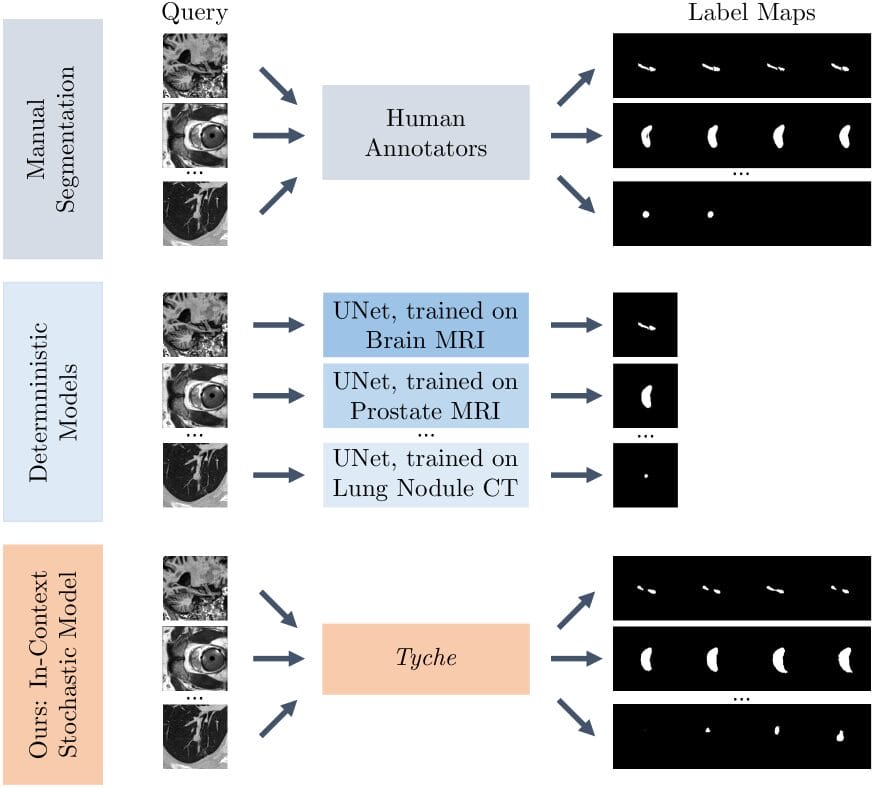 Researchers Build “tyche” To Embrace Uncertainty In Medical Imaging